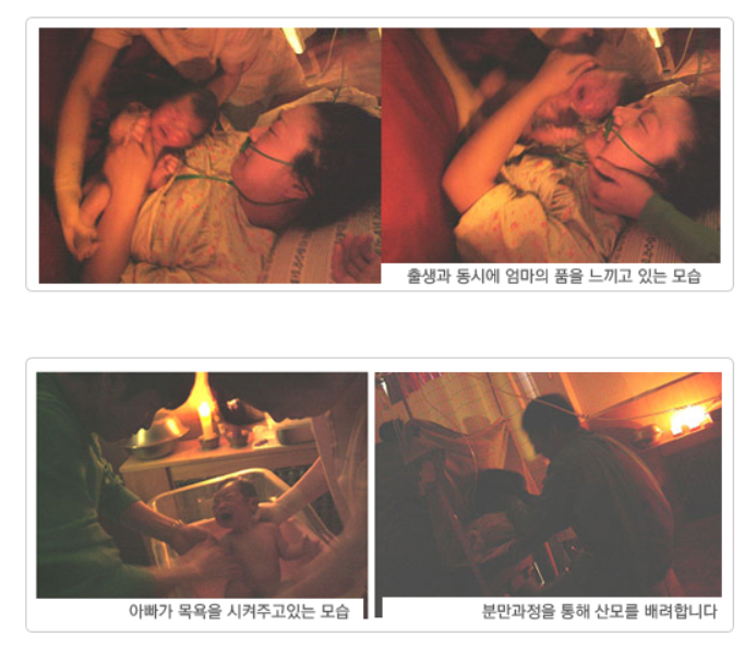 르봐이에분만 관련 이미지